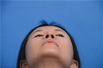 大连瑞和杨柠泽鼻部手术怎么样?案例分享