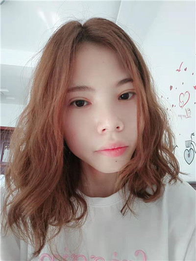 郑州东方黄军伟眼部综合怎么样?案例分享