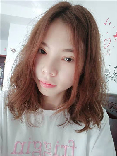 郑州东方黄军伟眼部综合怎么样?案例分享