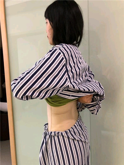 重庆瑞俪胡小义吸脂瘦腰腹怎么样?案例分享