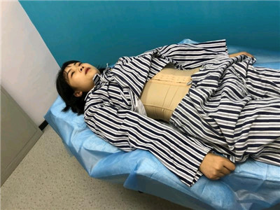 重庆瑞俪胡小义吸脂瘦腰腹怎么样?案例分享
