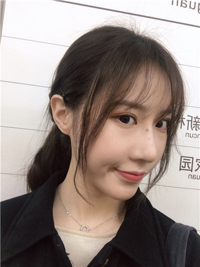 杭州艺星刘尊敏自体脂肪全脸填充怎么样?案例分享