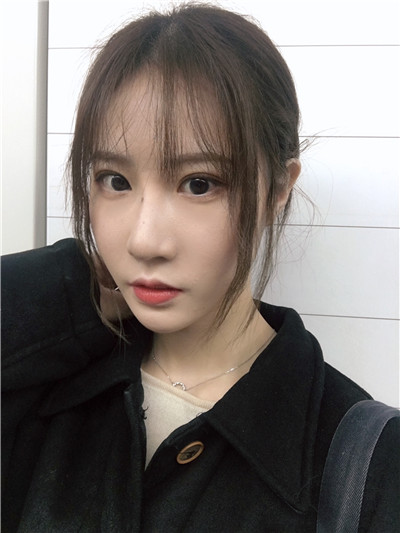 杭州艺星刘尊敏自体脂肪全脸填充怎么样?案例分享