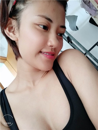深圳军科刘月更假体隆胸怎么样?案例分享