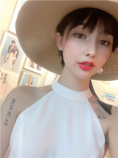 长沙你美彭文胜耳软骨复合隆鼻怎么样?案例分享