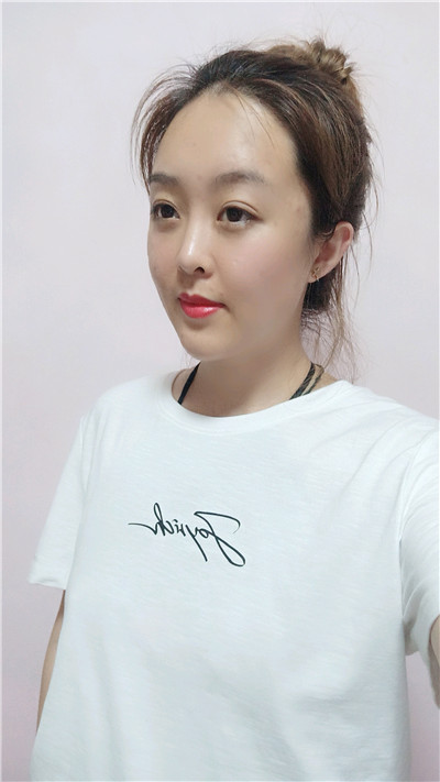 黑龙江瑞丽杨永胜自体脂肪全脸填充怎么样?案例分享