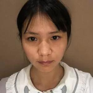 四川华美紫馨陈杨鼻部手术怎么样?案例分享