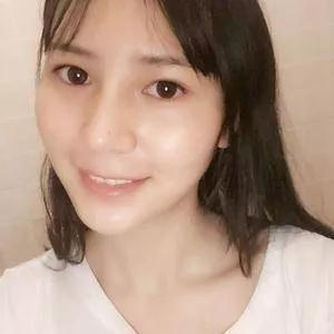四川华美紫馨陈杨鼻部手术怎么样?案例分享
