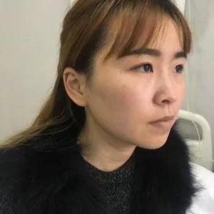 重庆军科乔少然眼鼻部手术怎么样?案例分享