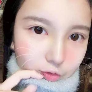 广州艺美李闯鼻部手术怎么样?案例分享