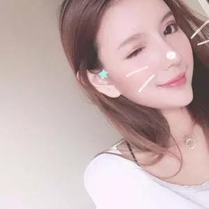 广州艺美李闯鼻部手术怎么样?案例分享