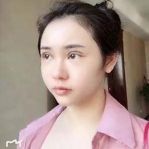 温州艺星黄乐眼部手术怎么样?案例分享