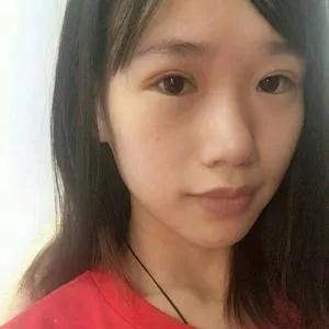 深圳艺星潘华眼部手术怎么样?案例分享