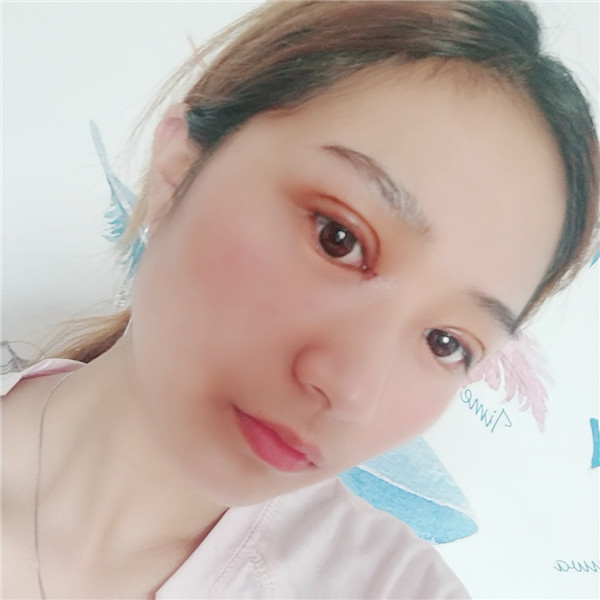 南京柠檬医疗双眼皮怎么样?