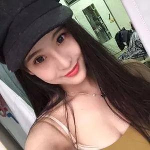 成都美容王立鹏全切双眼皮怎么样?案例分享