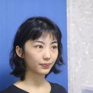 深圳健丽席海忠眼部手术怎么样?案例分享