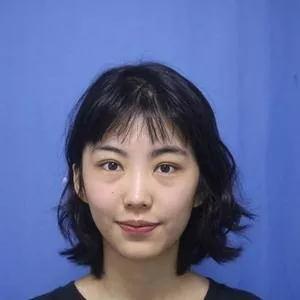 深圳健丽席海忠眼部手术怎么样?案例分享