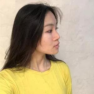杭州东方鼻部手术怎么样?案例分享