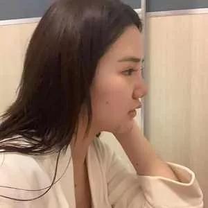 深圳阳光罗志敏鼻部手术怎么样?案例分享