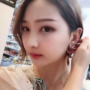 上海华美李志海下颌角+颧骨内推+眼部手术怎么样?案例分享