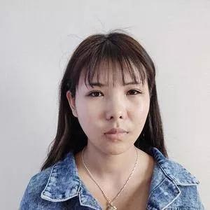 合肥白领安琪儿胡准鼻部手术怎么样?案例分享