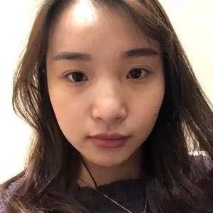 重庆军科范文亮鼻部手术怎么样?案例分享