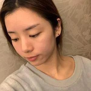 成都铜雀台雷刚鼻部手术怎么样?案例分享