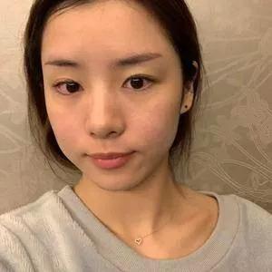 成都铜雀台雷刚鼻部手术怎么样?案例分享