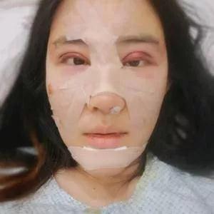北京叶美人丁雅晴眼鼻部手术怎么样?案例分享