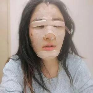 北京叶美人丁雅晴眼鼻部手术怎么样?案例分享
