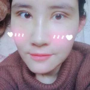 北京叶美人丁雅晴眼鼻部手术怎么样?案例分享