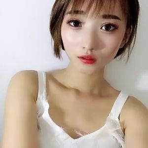 北京华悦府王宁博埋线双眼皮怎么样?案例分享