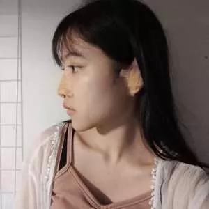长沙梵童陈仕文鼻部手术怎么样?案例分享