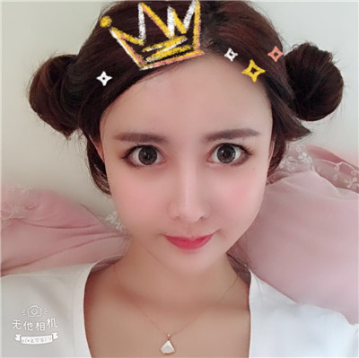 沈阳盛京尚美王超自体脂肪全脸填充怎么样?案例分享