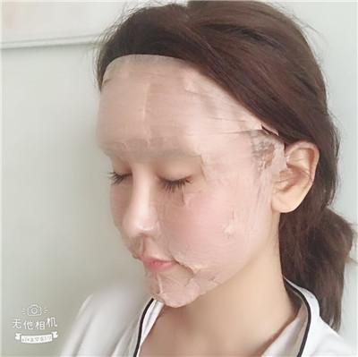 沈阳盛京尚美王超自体脂肪全脸填充怎么样?案例分享