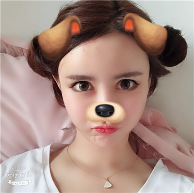 沈阳盛京尚美王超自体脂肪全脸填充怎么样?案例分享