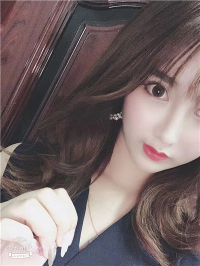 沈阳盛京尚美王超自体脂肪全脸填充怎么样?案例分享
