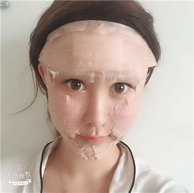 沈阳盛京尚美王超自体脂肪全脸填充怎么样?案例分享