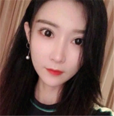 南昌永康王忠干自体脂肪全脸填充怎么样?案例分享