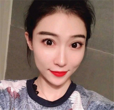 南昌永康王忠干自体脂肪全脸填充怎么样?案例分享