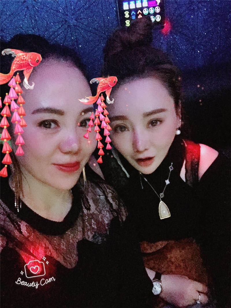上海御颜刘柏林割双眼皮怎么样?案例分享