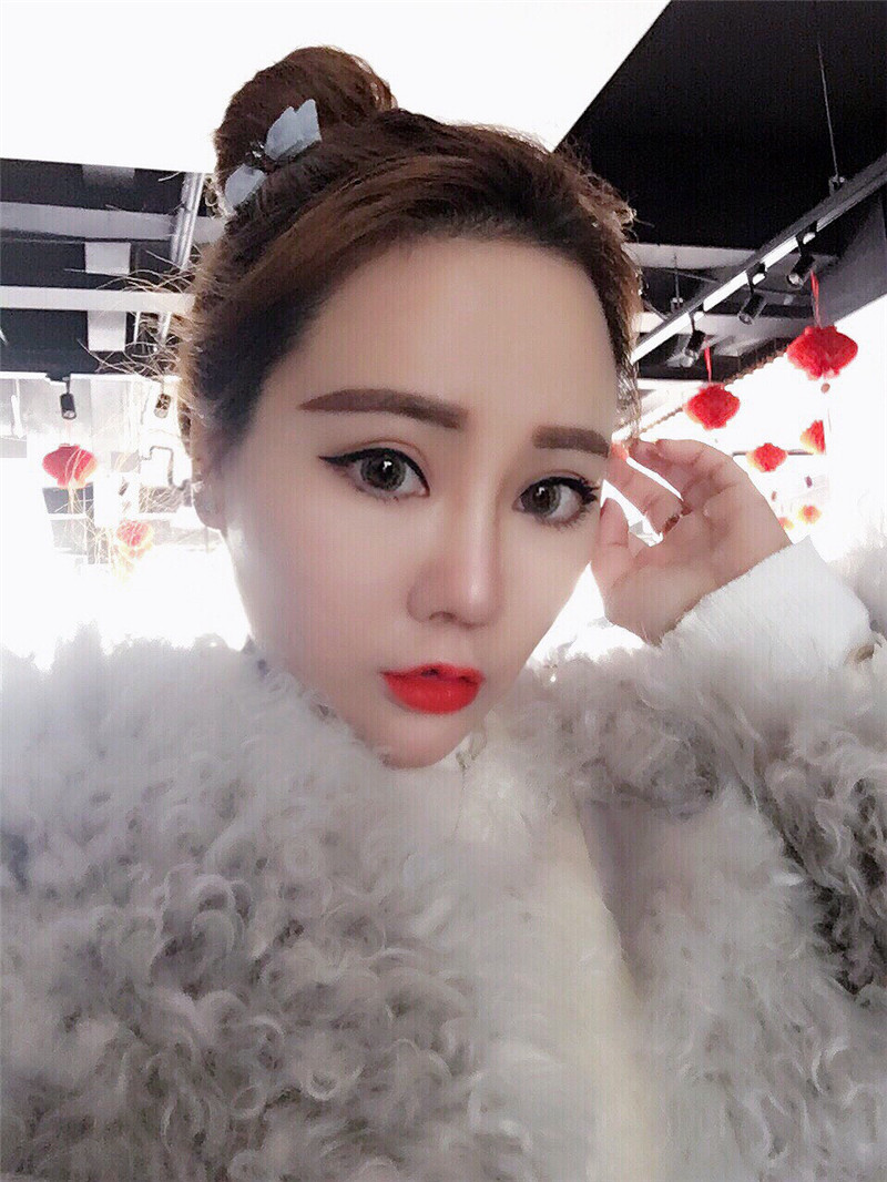 上海御颜刘柏林割双眼皮怎么样?案例分享