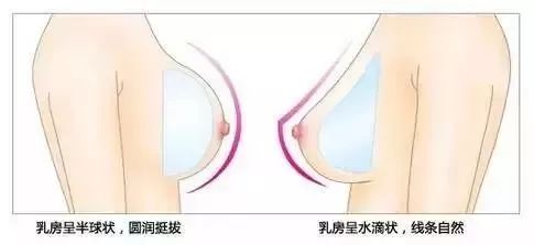 隆胸和真胸,你能区分出来?